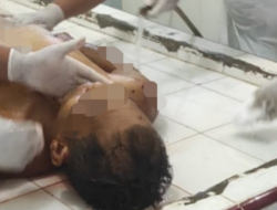 Tewas di Duga di Aniaya “Oknum TNI”, Foto Jenazah JH : Tangan, Badan dan Kepala Ada Bekas Seperti Luka 