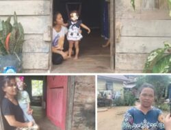 Anak Penderita Kurang Gizi di Tapteng Butuh Penangan Serius